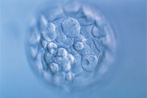 http://xiamen.quanwangkm.com/post/190.html|厦门人工试管